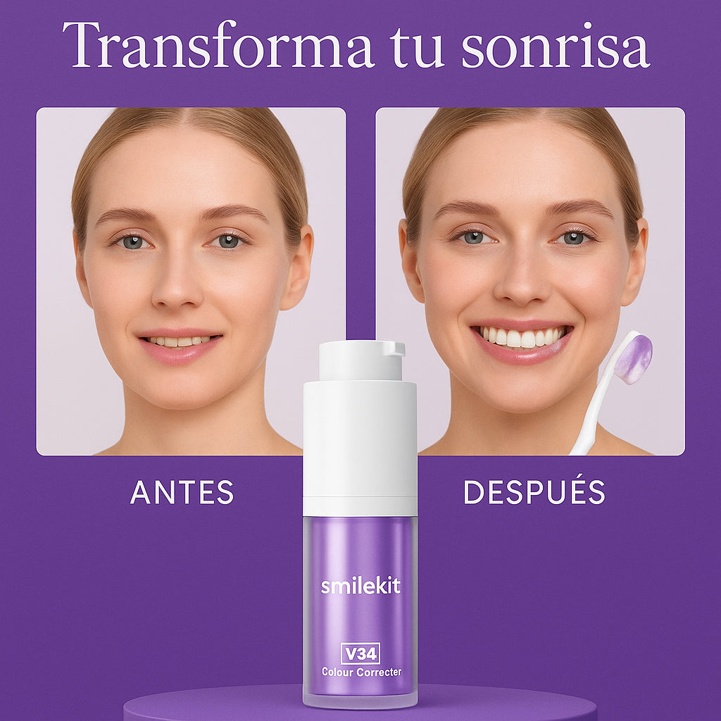 Blanqueador Dental SmileKit™ V34 - Dientes más blancos en 2 minutos
