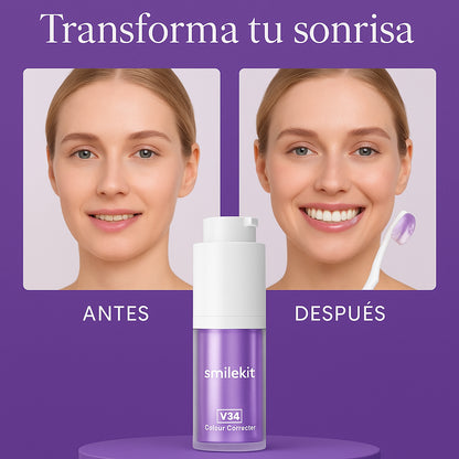 Blanqueador Dental SmileKit™ V34 - Dientes más blancos en 2 minutos