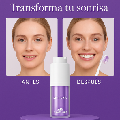 Blanqueador Dental SmileKit™ V34 | Dientes Más Blancos en 2 Minutos