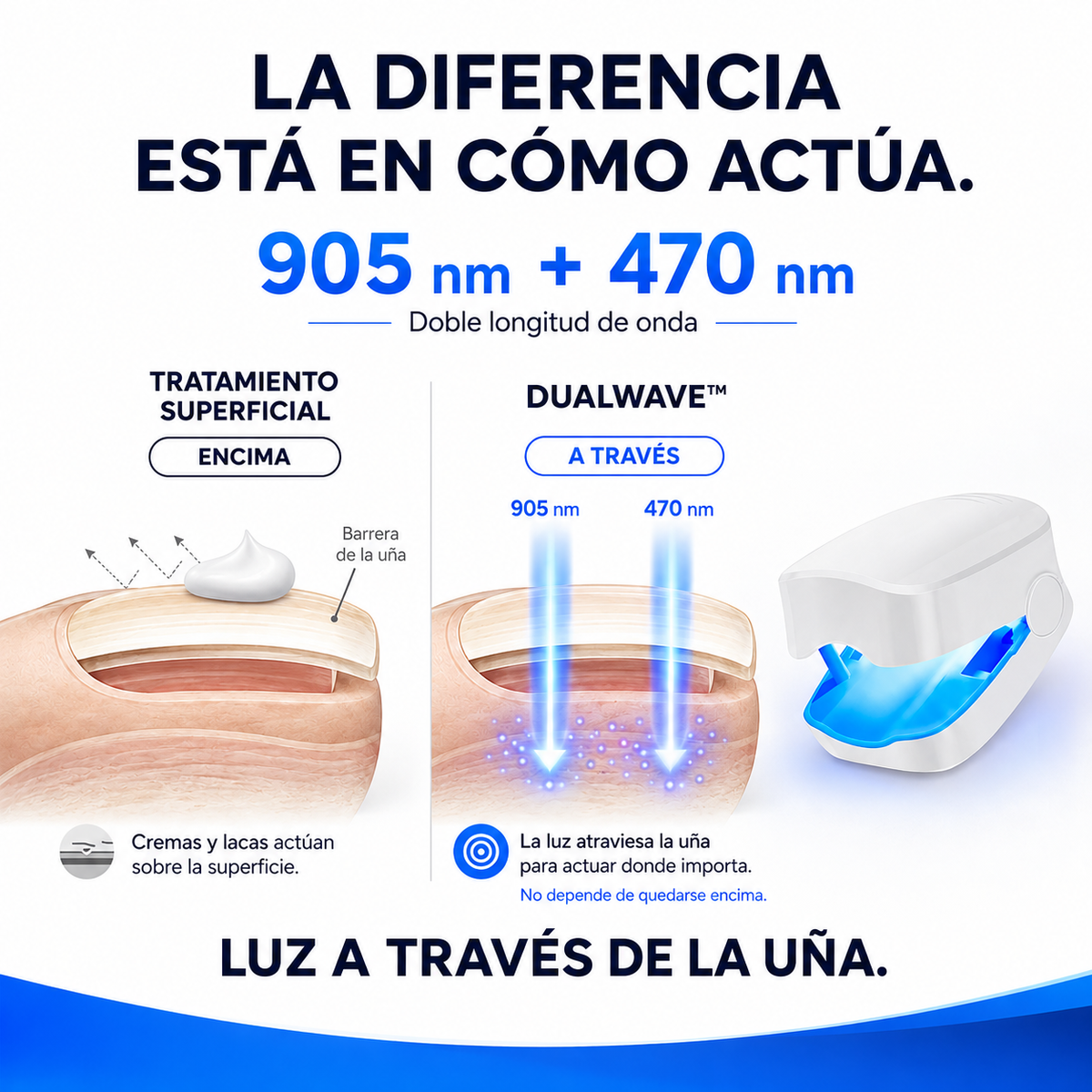 DualWave™ | Láser 905+470 nm para Hongos en las Uñas