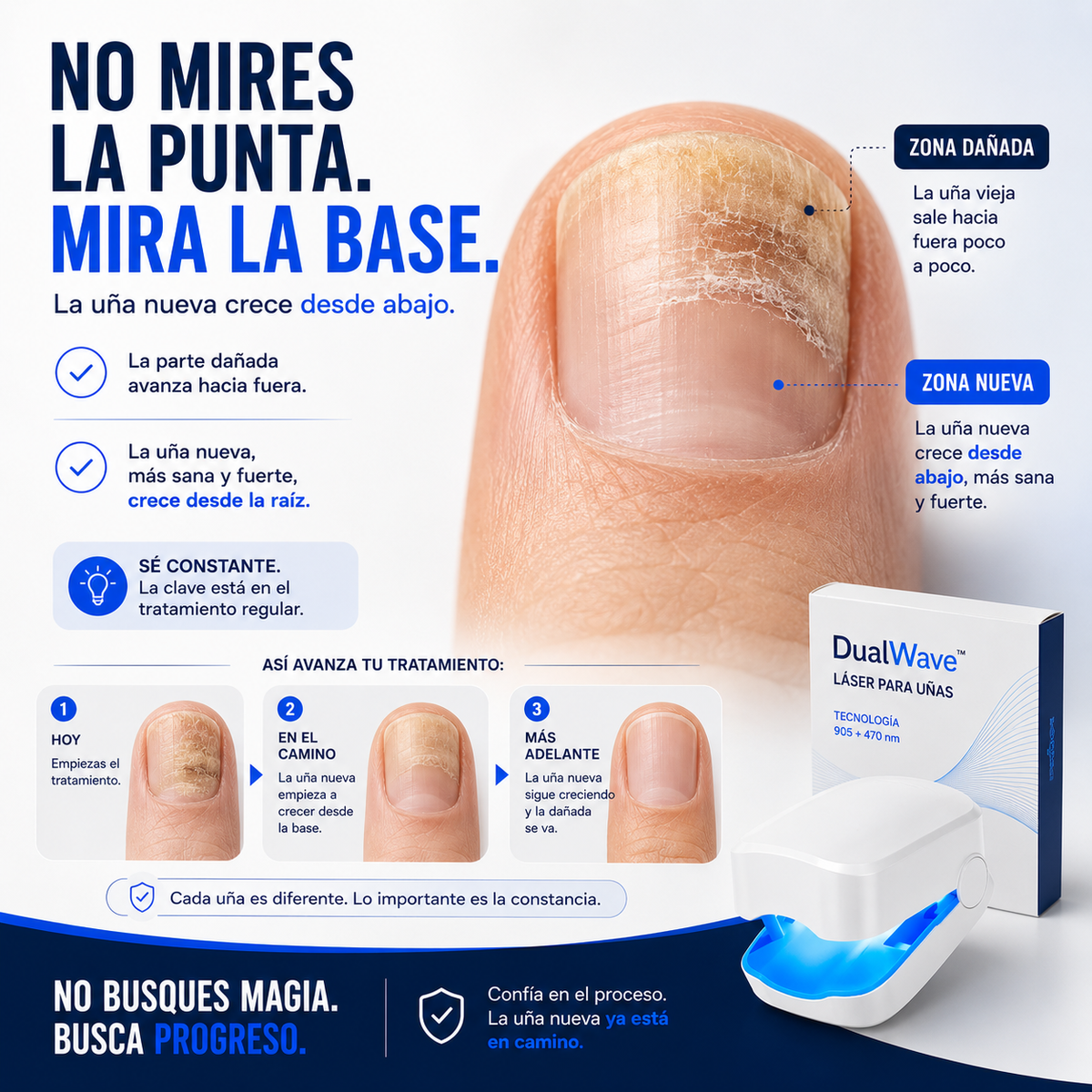 DualWave™ | Láser 905+470 nm para Hongos en las Uñas