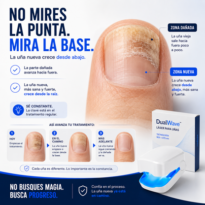 DualWave™ | Láser 905+470 nm para Hongos en las Uñas