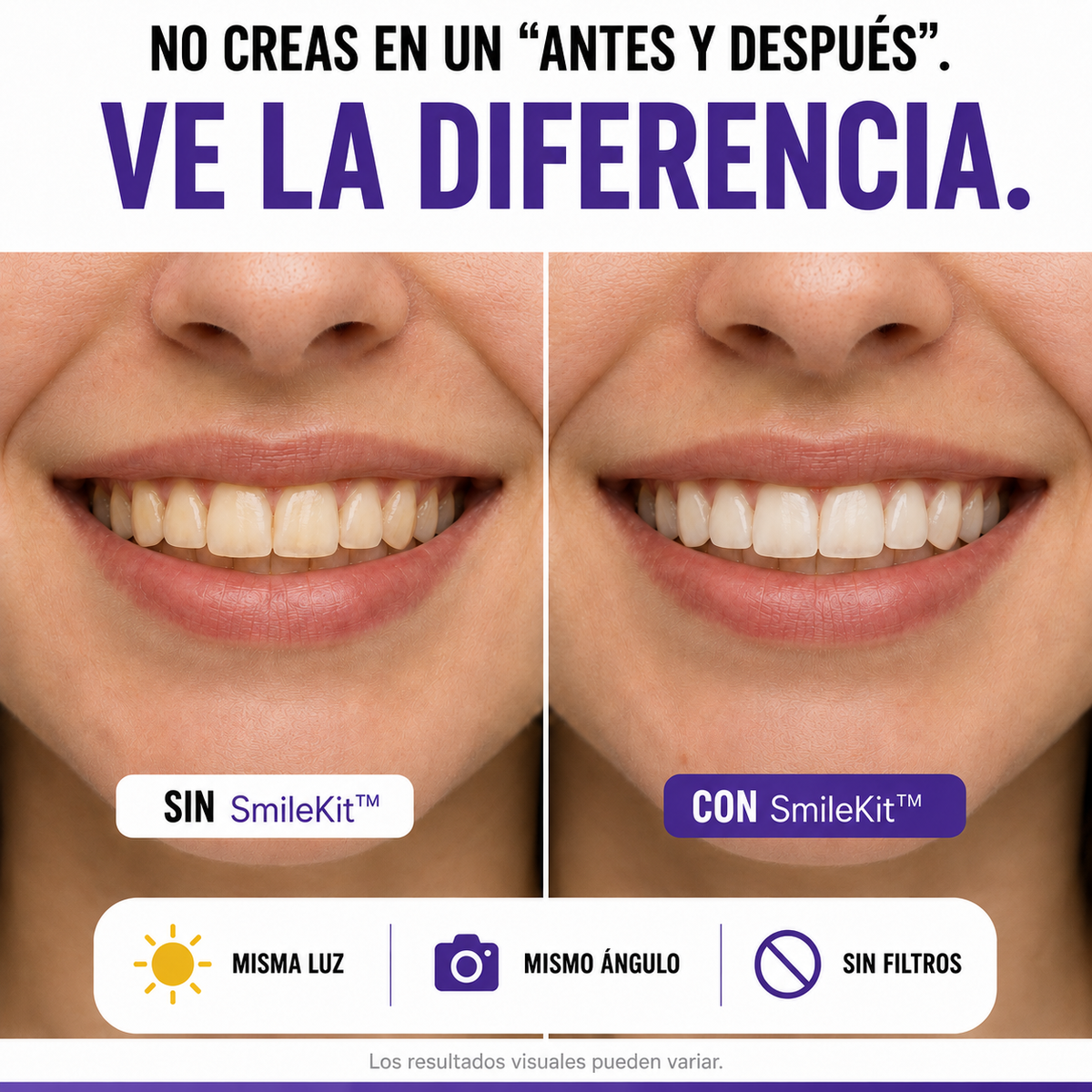 Serum Blanqueador Dental SmileKit™ V34