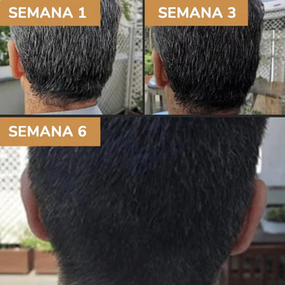 JABÓN ELIMINADOR DE CANAS NATURAL COVERSOAP™