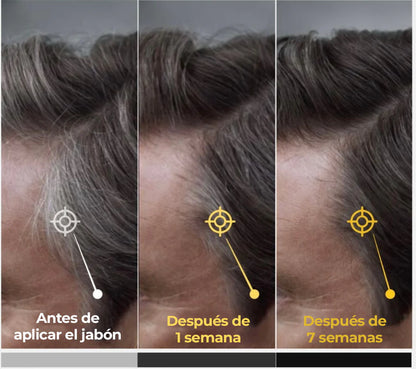JABÓN ELIMINADOR DE CANAS NATURAL COVERSOAP™